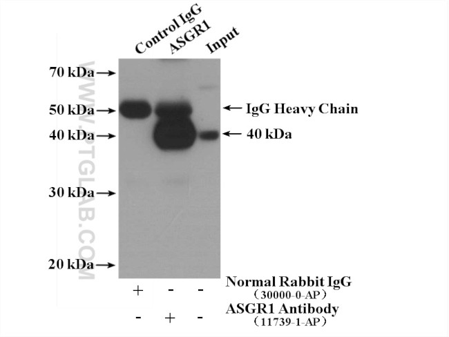 ASGR1 Antibody in Immunoprecipitation (IP)