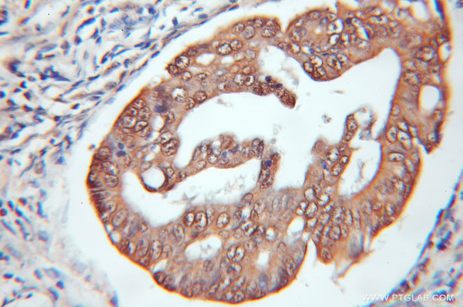 BCL7B Antibody in Immunohistochemistry (Paraffin) (IHC (P))