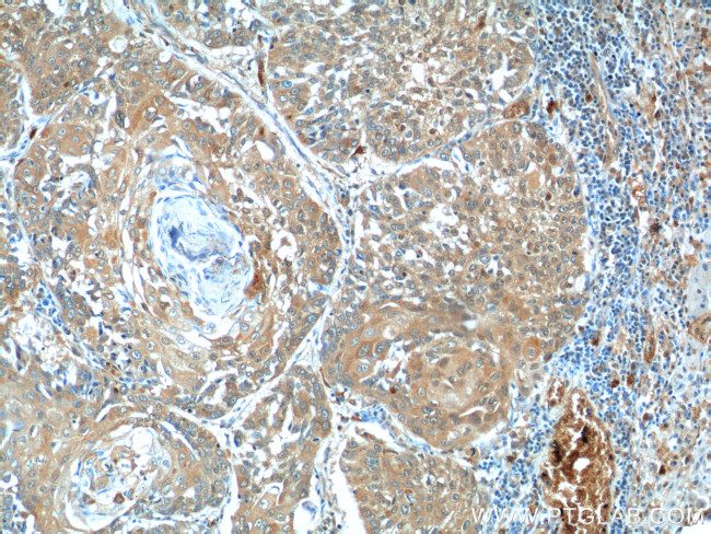 BCL7B Antibody in Immunohistochemistry (Paraffin) (IHC (P))