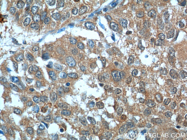 BCL7B Antibody in Immunohistochemistry (Paraffin) (IHC (P))