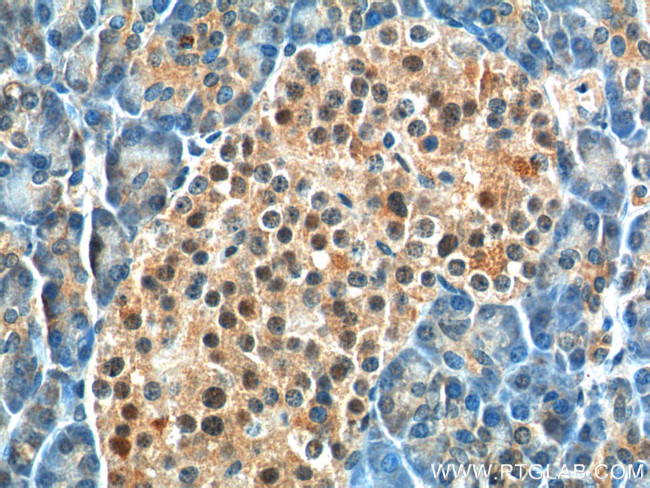 BCL7B Antibody in Immunohistochemistry (Paraffin) (IHC (P))