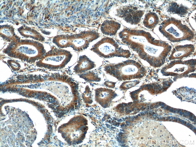 BCL7B Antibody in Immunohistochemistry (Paraffin) (IHC (P))