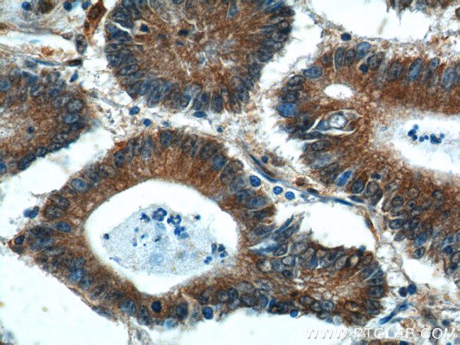 BCL7B Antibody in Immunohistochemistry (Paraffin) (IHC (P))