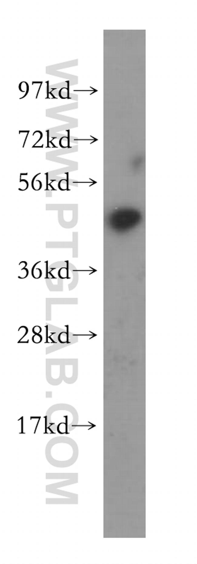 BCL7B Antibody in Western Blot (WB)