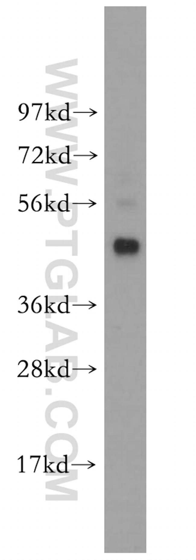 BCL7B Antibody in Western Blot (WB)