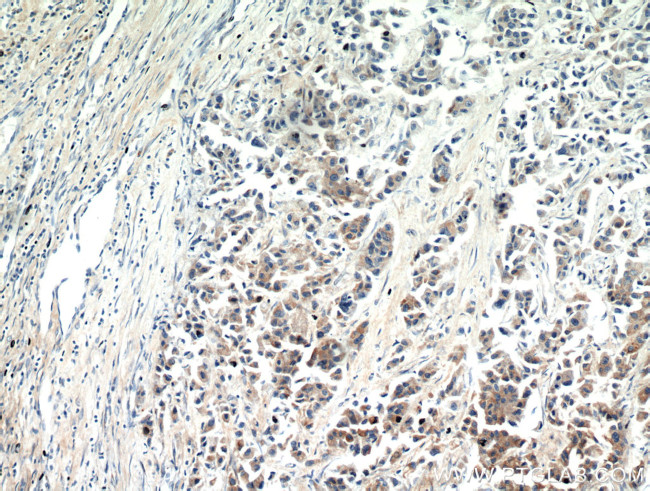 SPRR3 Antibody in Immunohistochemistry (Paraffin) (IHC (P))