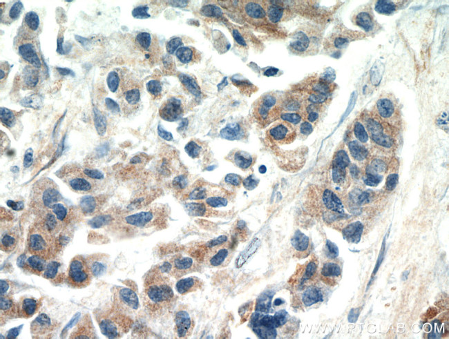 SPRR3 Antibody in Immunohistochemistry (Paraffin) (IHC (P))