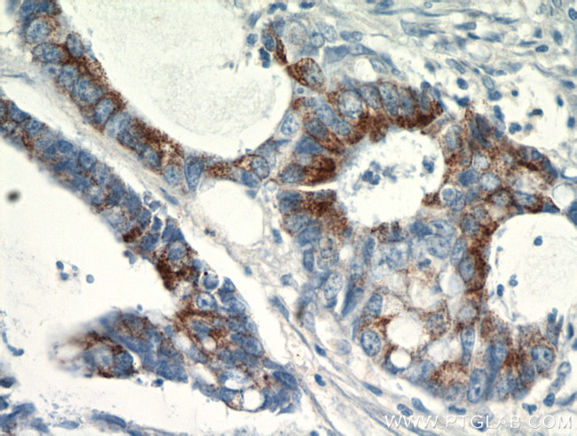 SPRR3 Antibody in Immunohistochemistry (Paraffin) (IHC (P))