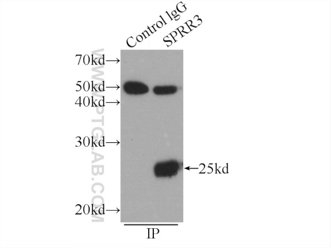 SPRR3 Antibody in Immunoprecipitation (IP)