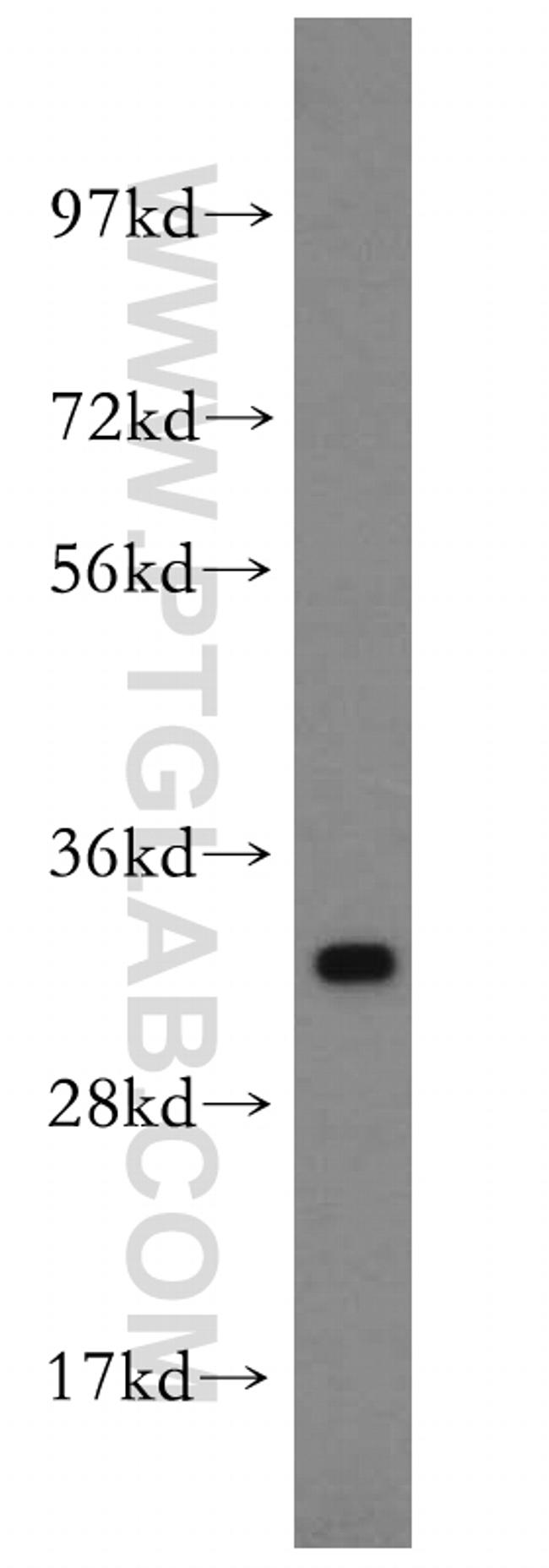 SPRR3 Antibody in Western Blot (WB)