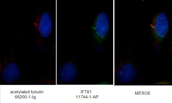 IFT81 Antibody in Immunocytochemistry (ICC/IF)