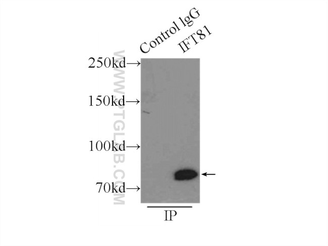 IFT81 Antibody in Immunoprecipitation (IP)