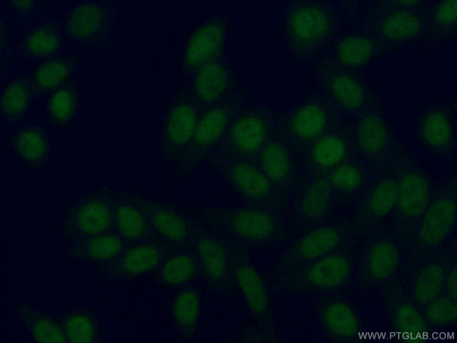 HBP1 Antibody in Immunocytochemistry (ICC/IF)