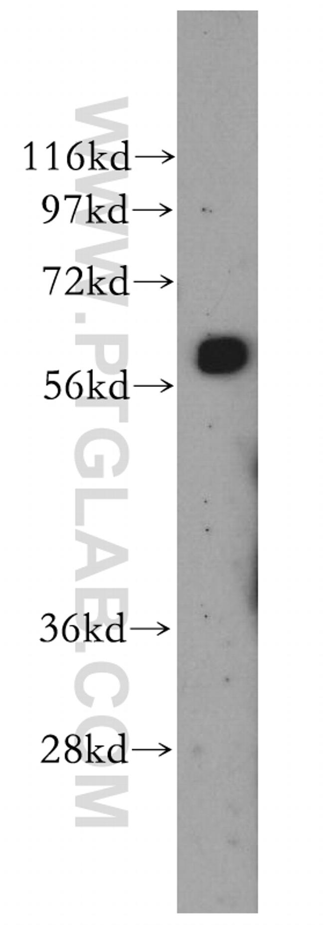 HBP1 Antibody in Western Blot (WB)