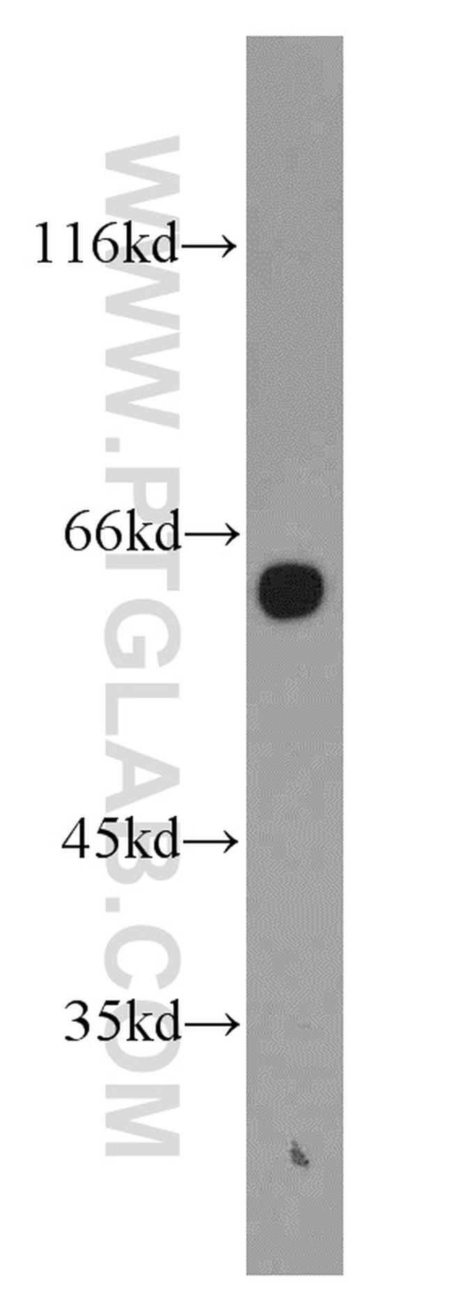 HBP1 Antibody in Western Blot (WB)