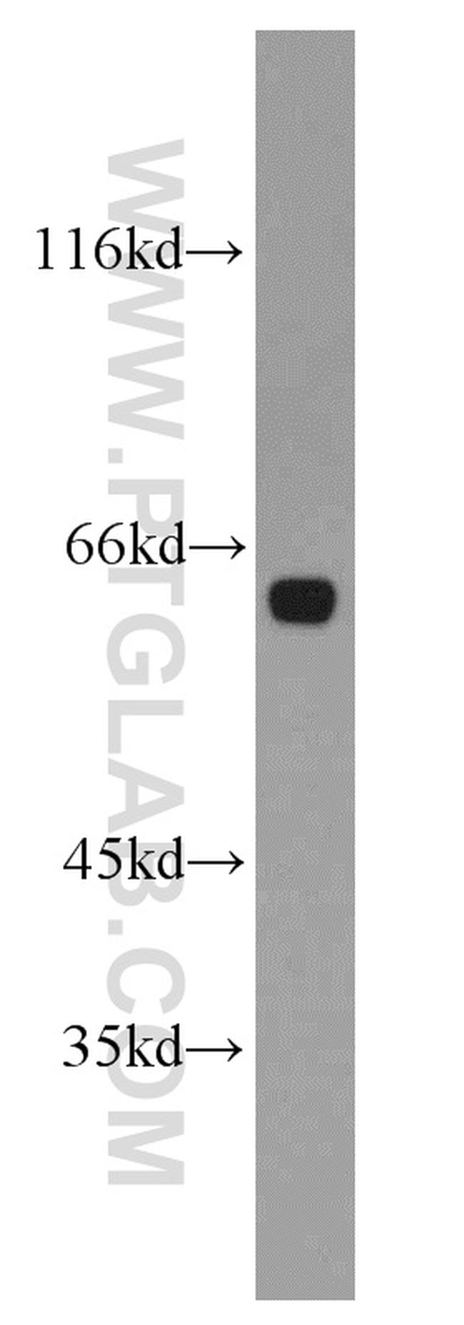 HBP1 Antibody in Western Blot (WB)