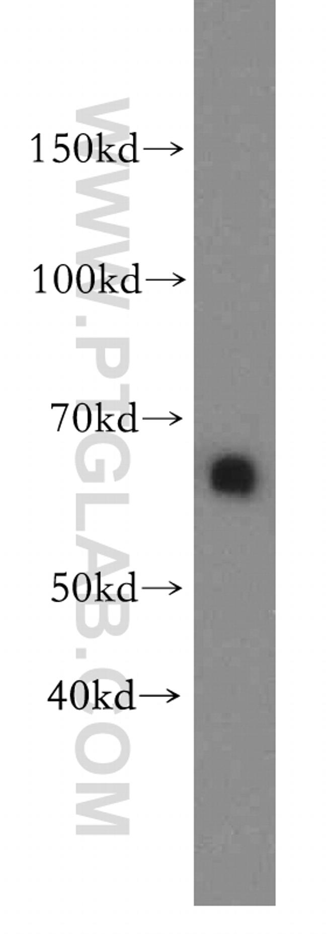 HBP1 Antibody in Western Blot (WB)