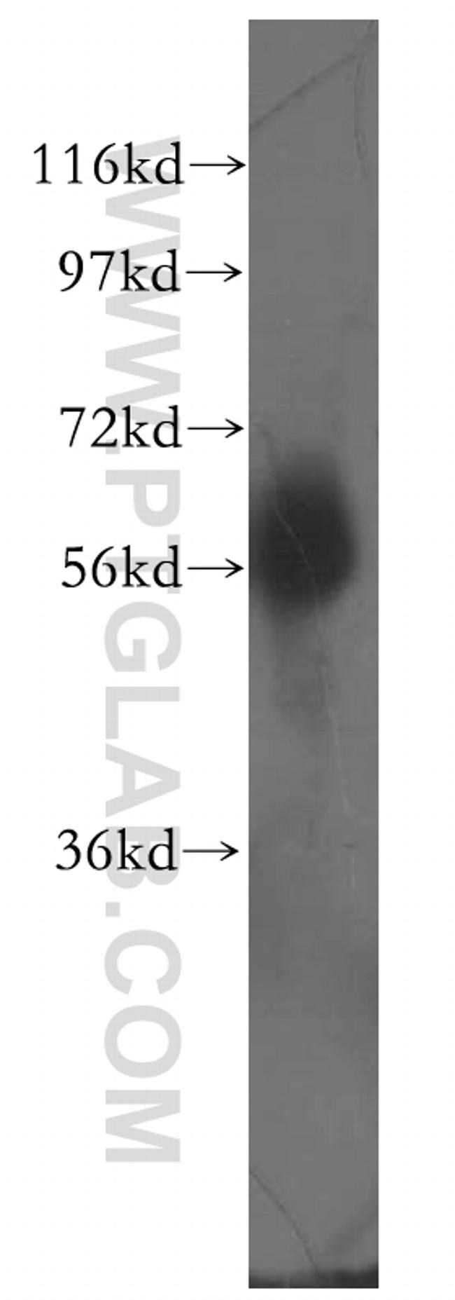 DCLRE1C Antibody in Western Blot (WB)