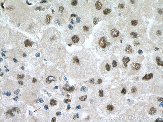 PSMB1 Antibody in Immunohistochemistry (Paraffin) (IHC (P))