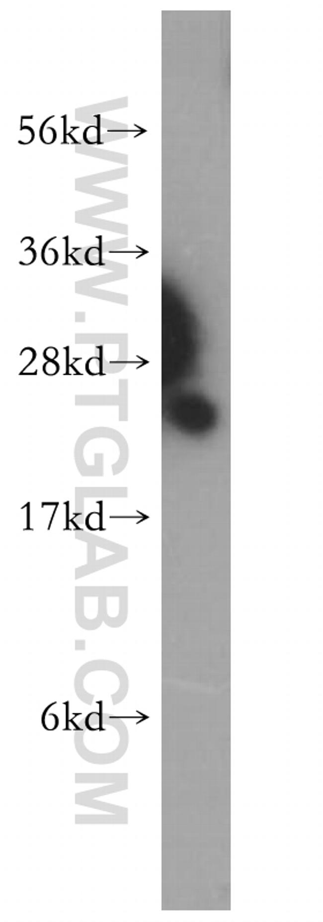 PSMB1 Antibody in Western Blot (WB)