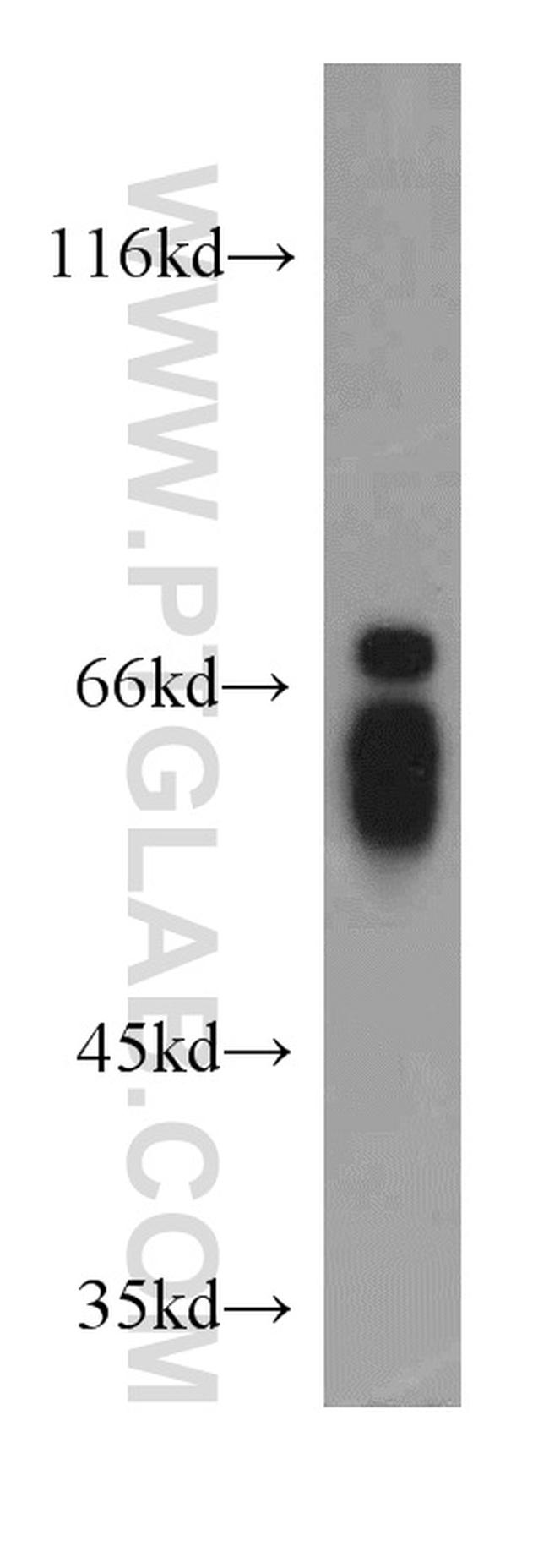 NFIA Antibody in Western Blot (WB)