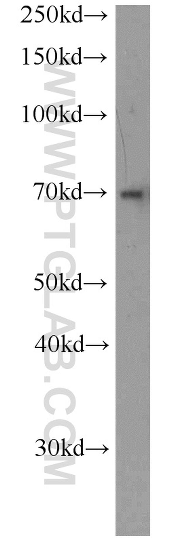 NFIA Antibody in Western Blot (WB)