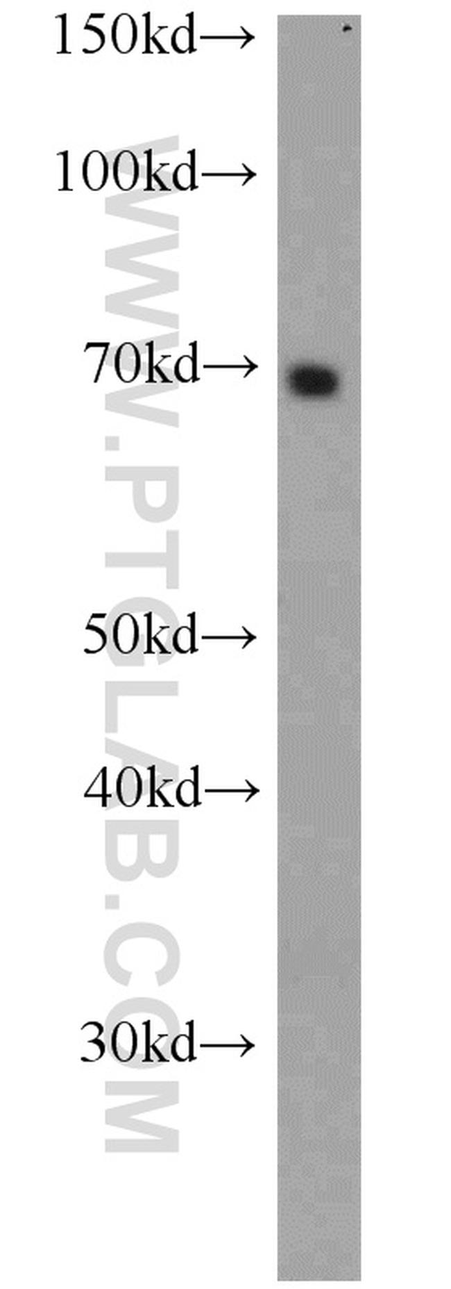 NFIA Antibody in Western Blot (WB)