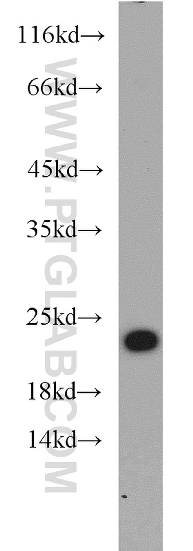 TWIST2 Antibody in Western Blot (WB)