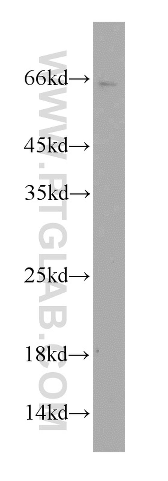 TWIST2 Antibody in Western Blot (WB)