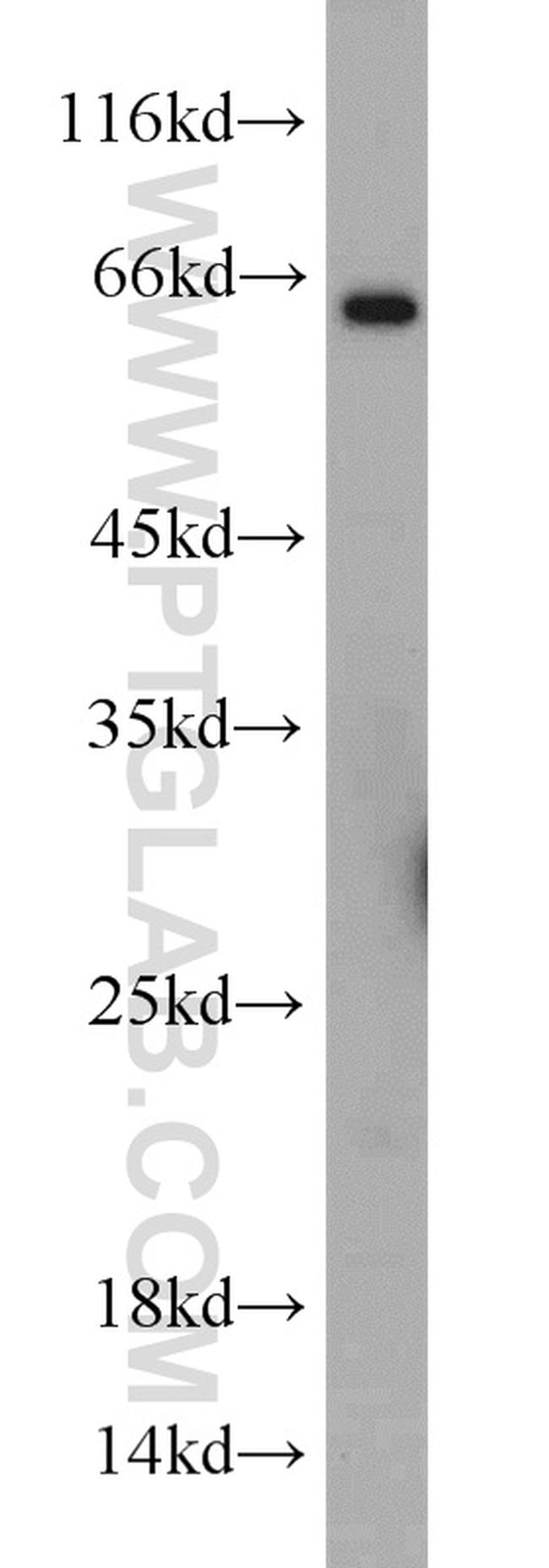 TWIST2 Antibody in Western Blot (WB)