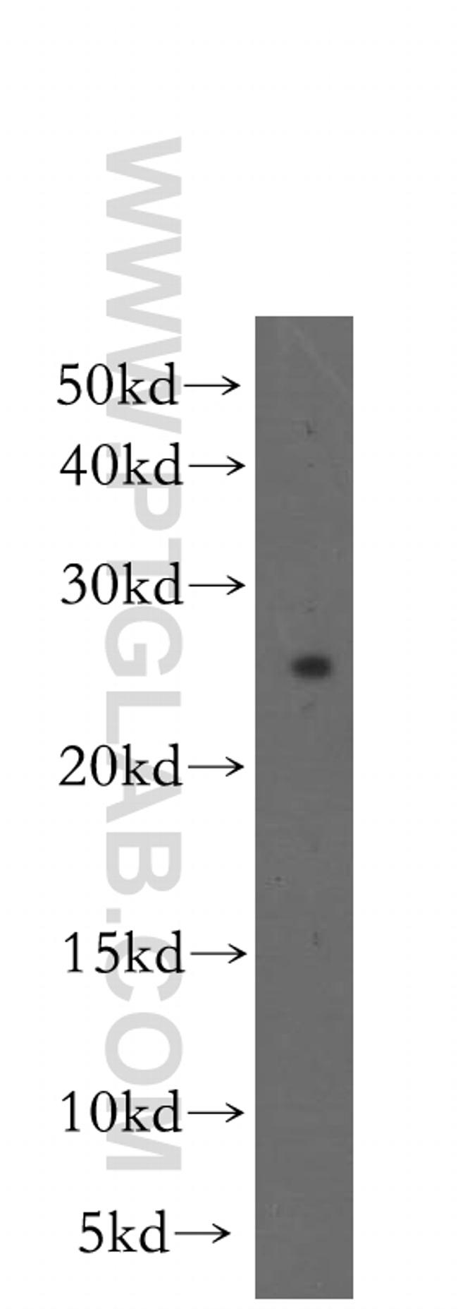 FKBP3 Antibody in Western Blot (WB)