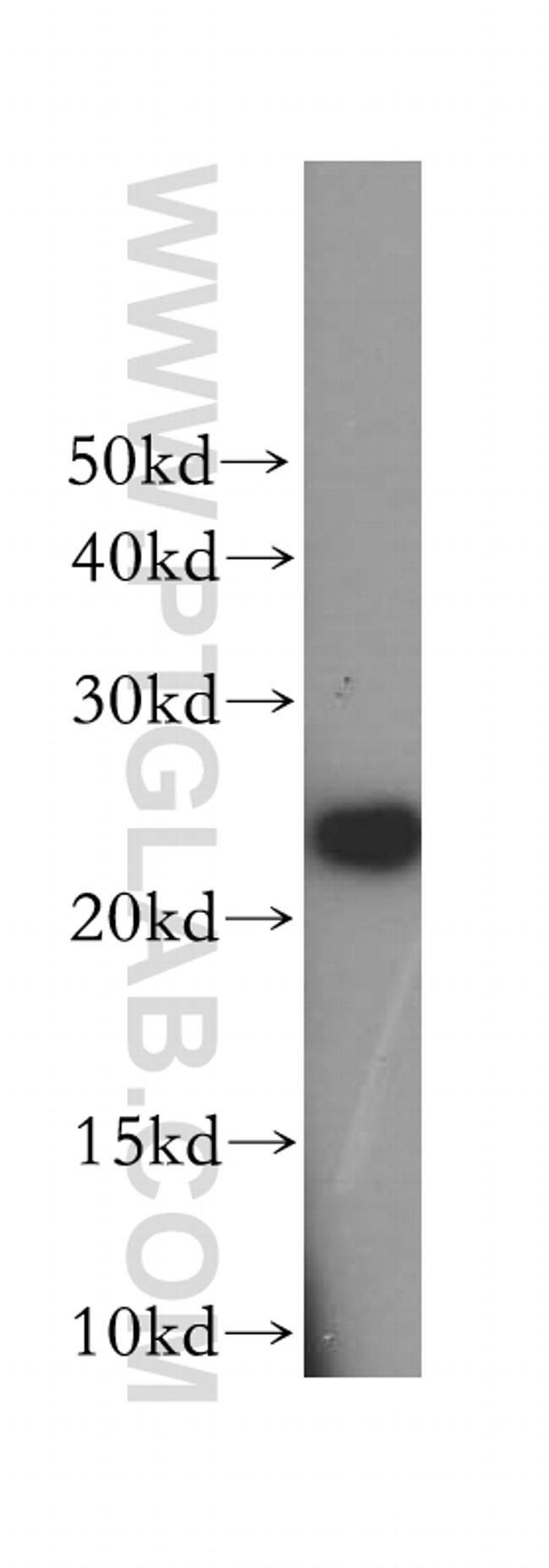 FKBP3 Antibody in Western Blot (WB)