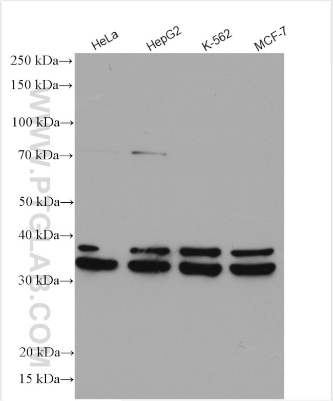 HNRNPC Antibody in Western Blot (WB)