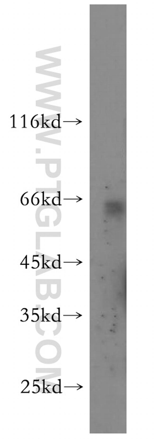 PANK1 Antibody in Western Blot (WB)