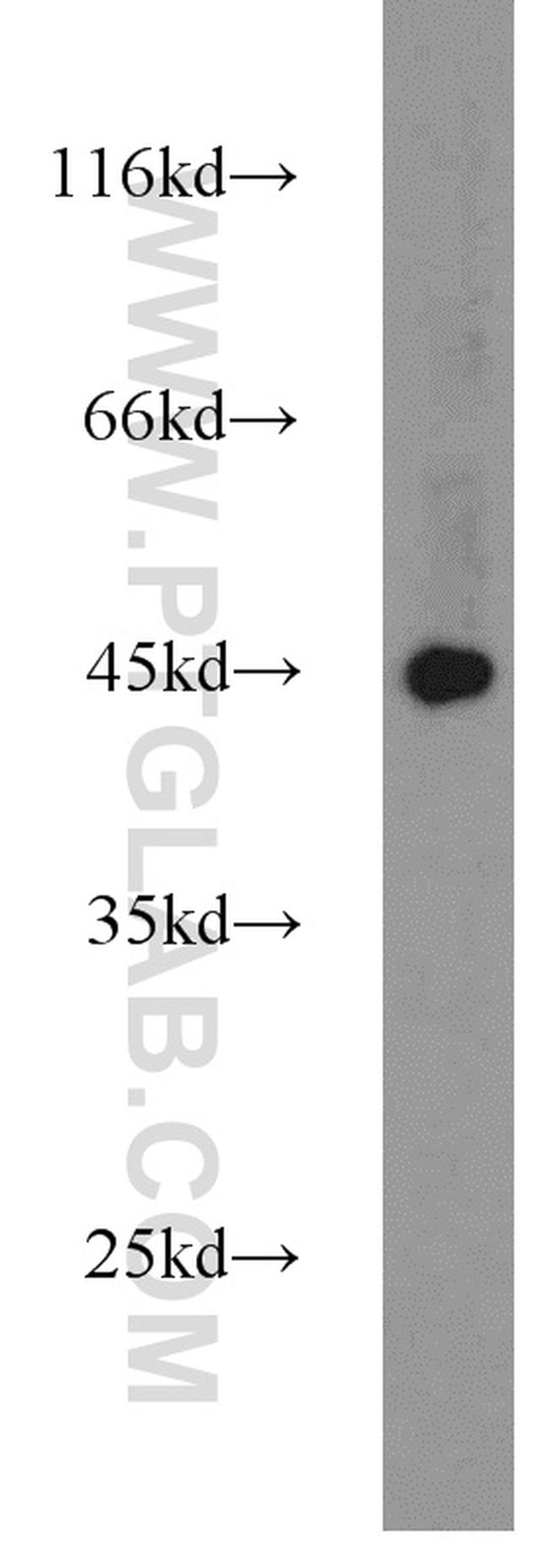 PANK1 Antibody in Western Blot (WB)