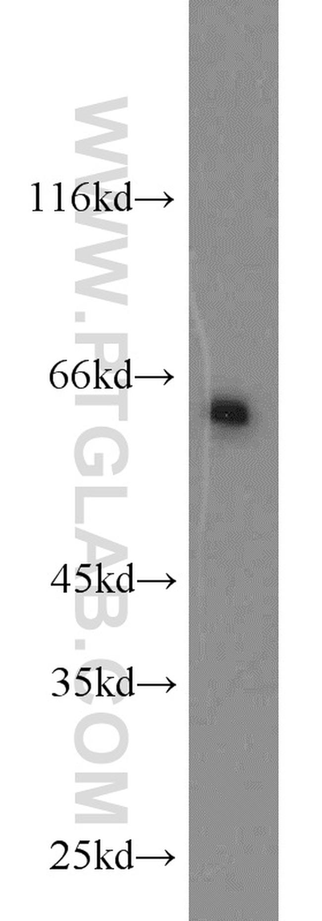 NFIL3 Antibody in Western Blot (WB)