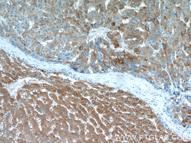 RBP4 Antibody in Immunohistochemistry (Paraffin) (IHC (P))