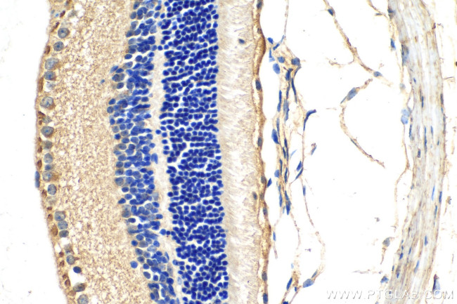 RBP4 Antibody in Immunohistochemistry (Paraffin) (IHC (P))