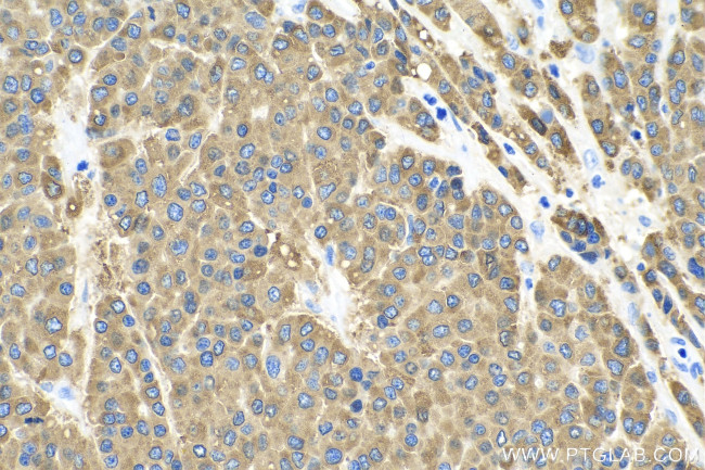 RBP4 Antibody in Immunohistochemistry (Paraffin) (IHC (P))