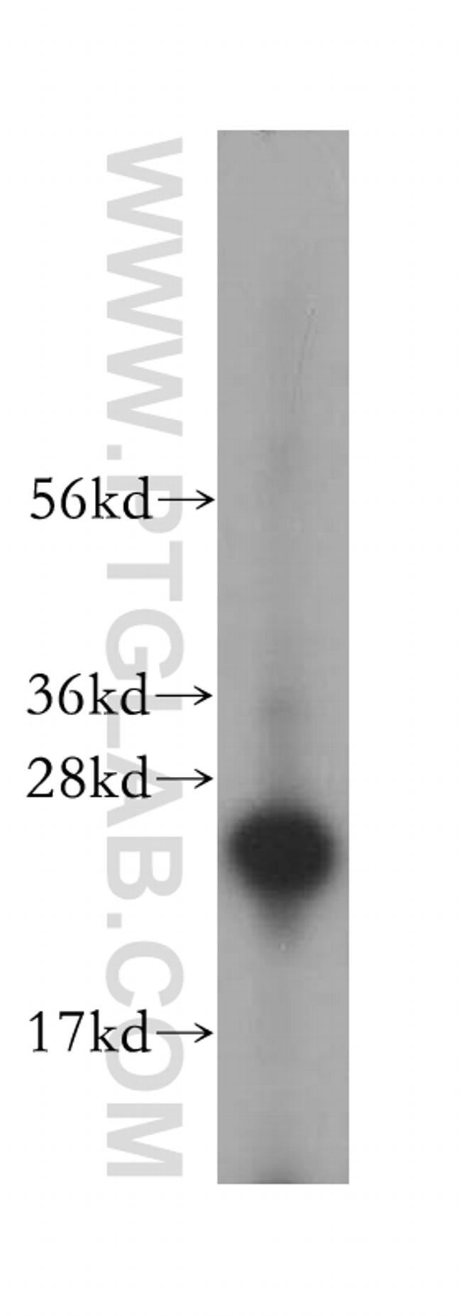 RBP4 Antibody in Western Blot (WB)