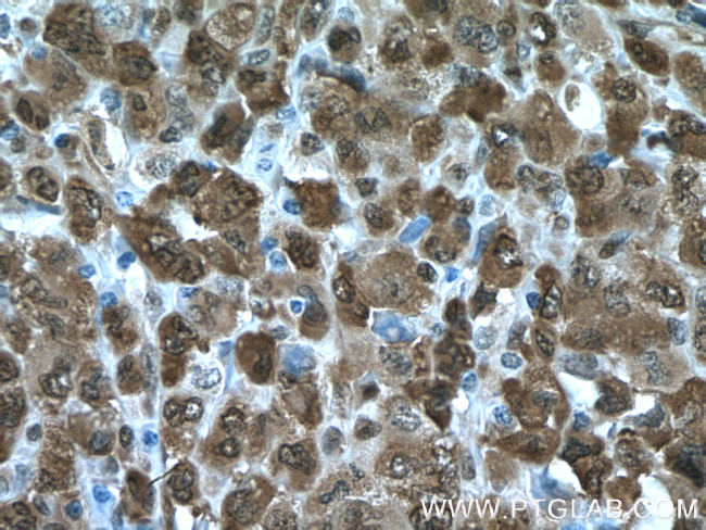 NAMPT/PBEF Antibody in Immunohistochemistry (Paraffin) (IHC (P))