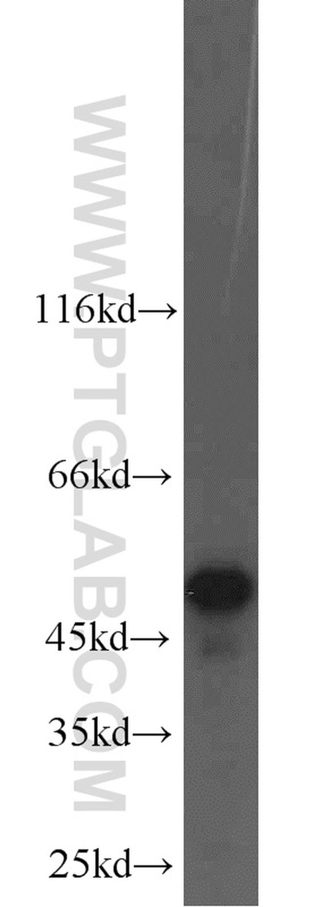 NAMPT/PBEF Antibody in Western Blot (WB)