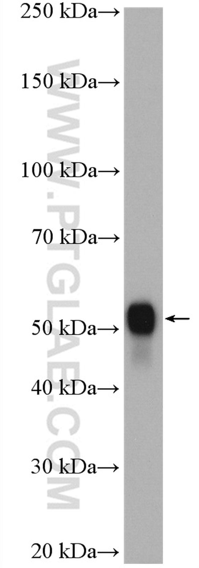 NAMPT/PBEF Antibody in Western Blot (WB)