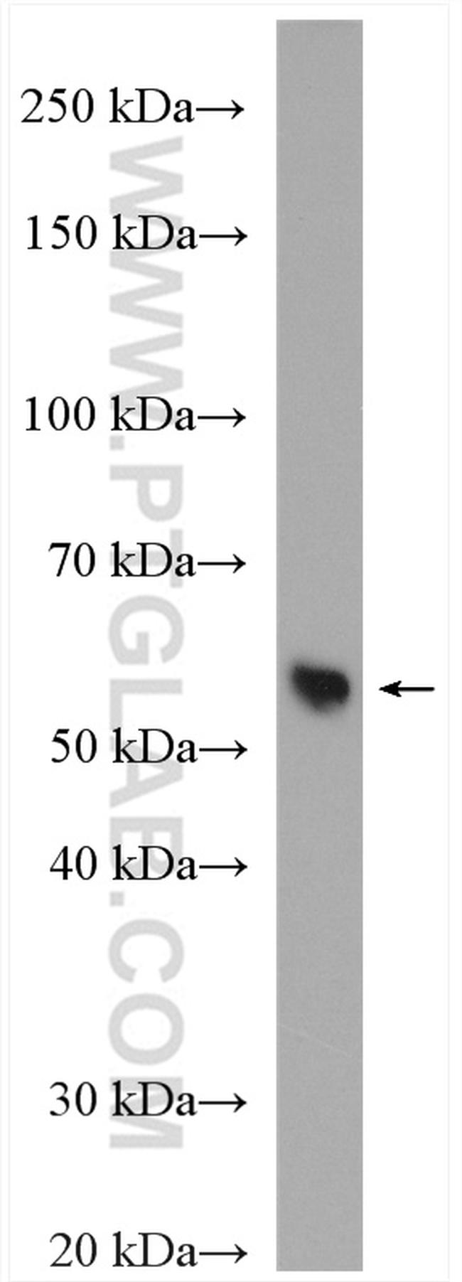 NAMPT/PBEF Antibody in Western Blot (WB)