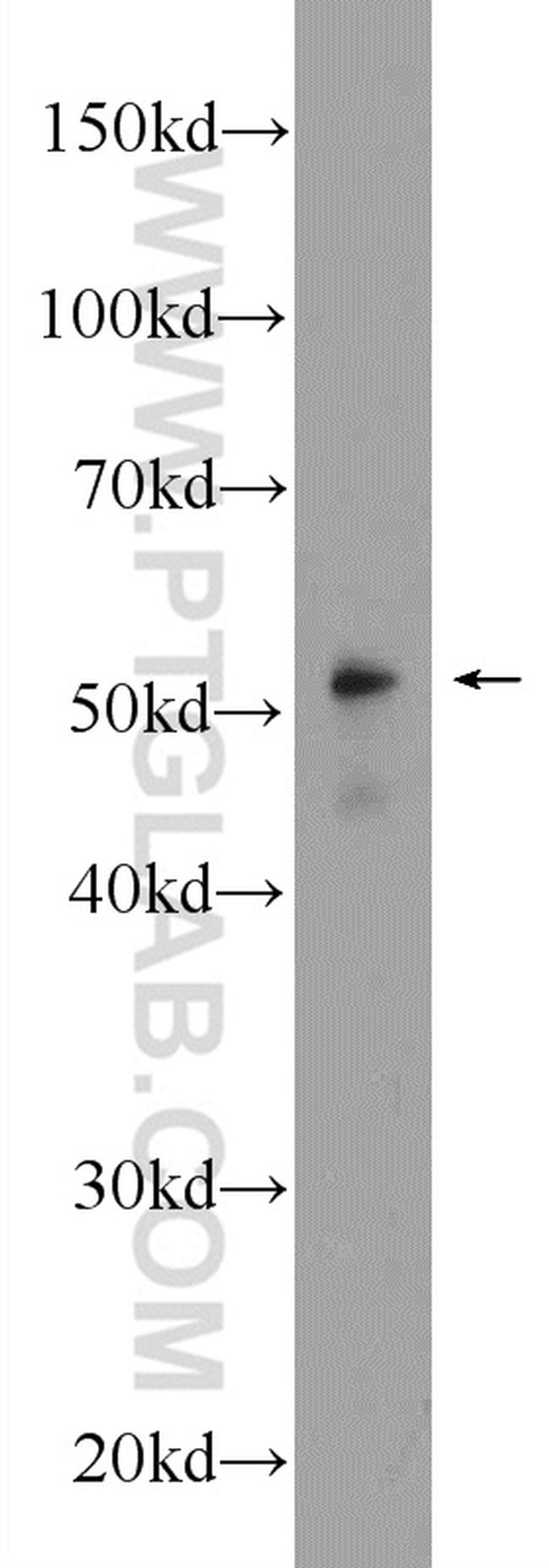 NAMPT/PBEF Antibody in Western Blot (WB)