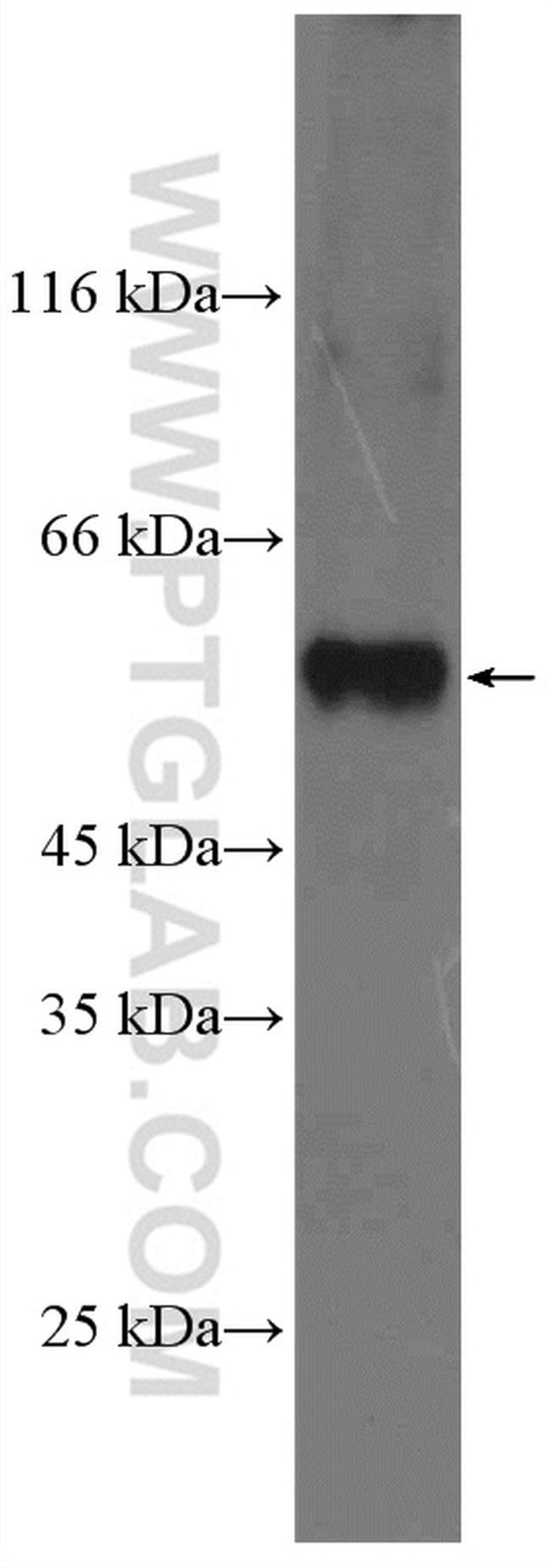 NAMPT/PBEF Antibody in Western Blot (WB)