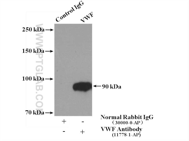 VWF/VWFpp Antibody in Immunoprecipitation (IP)