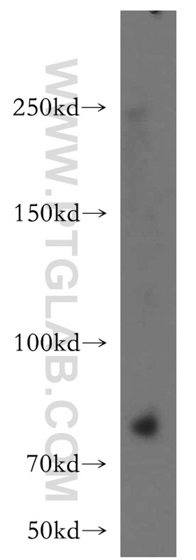 VWF/VWFpp Antibody in Western Blot (WB)