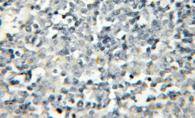 PTPN22 Antibody in Immunohistochemistry (Paraffin) (IHC (P))