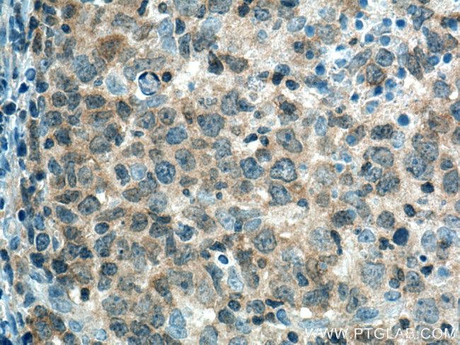 PTPN22 Antibody in Immunohistochemistry (Paraffin) (IHC (P))